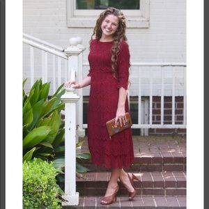 Dainty Jewell’s dress